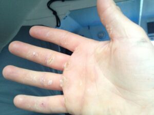 Jason's hand